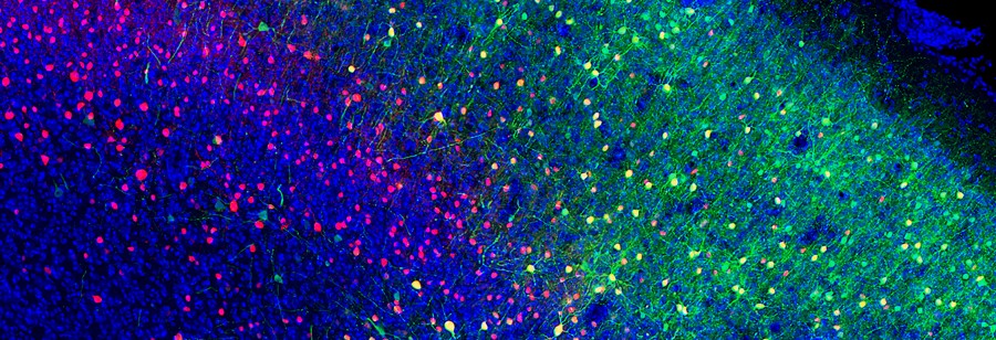 Cross section of visual cortex showing neurons expressing fluorescent green optogens at the border. 
